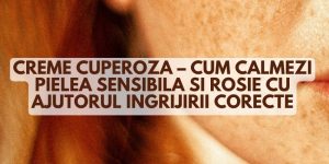 creme cuperoza crema