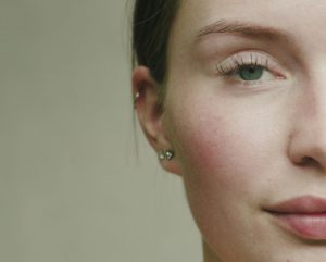 creme cuperoza, cuperoza crema, creme pentru cuperoza