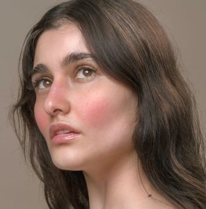 creme cuperoza, cuperoza crema, creme pentru cuperoza